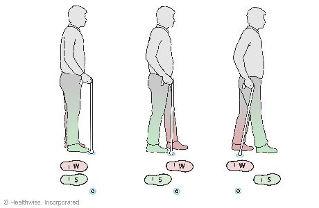Proper walking sequence using a cane with the weaker leg